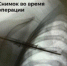 Врачи спасли 12-летнюю балерину с редкой патологией - у девочки не было кости - КТВ-ЛУЧ